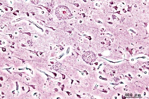 una estrategia sistemtica para descubrir nuevos fitofrmacos para el alzheimer una estrategia sistemtica para descubrir nuevos fitofrmacos para el alzheimer