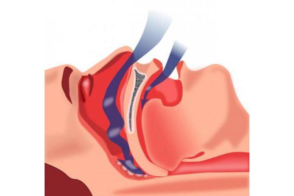 un parche desechable para diagnosticar fiablemente la apnea del sueo un parche desechable para diagnosticar fiablemente la apnea del sueo