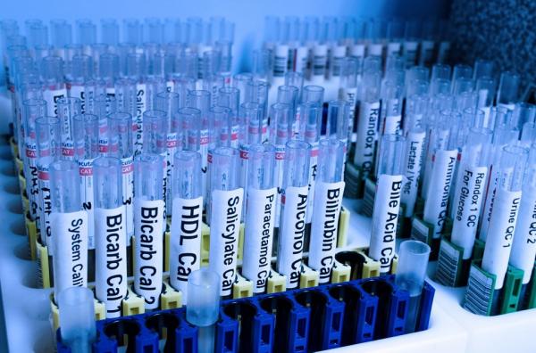 la seguridad de celecoxib es similar al de los antiinflamatorios no esteroideos la seguridad de celecoxib es similar al de los antiinflamatorios no esteroideos