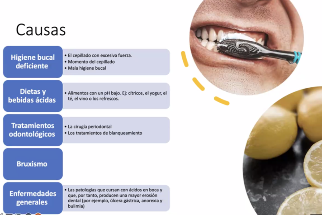 la-hipersensibilidad-dental-una-consulta-muy-presente-en-la-farmacia