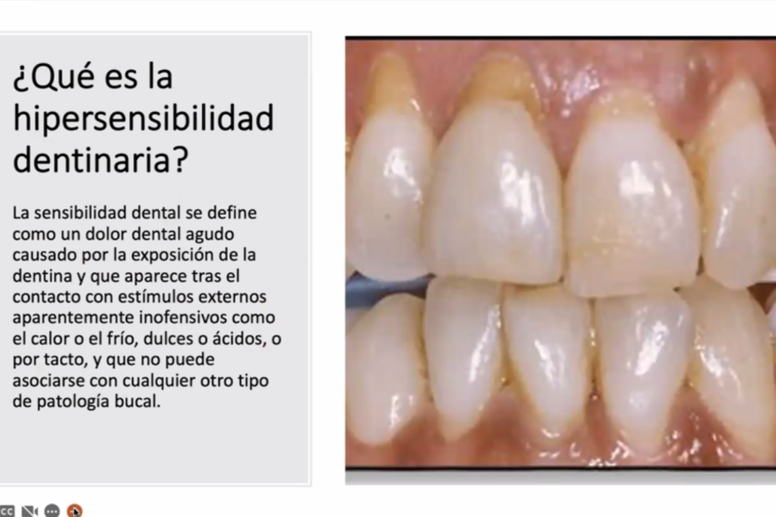 la-hipersensibilidad-dental-una-consulta-muy-presente-en-la-farmacia